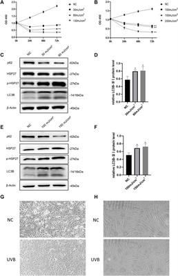 HSP27 Protects Skin From Ultraviolet B -Induced Photodamage by Regulating Autophagy and Reactive Oxygen Species Production